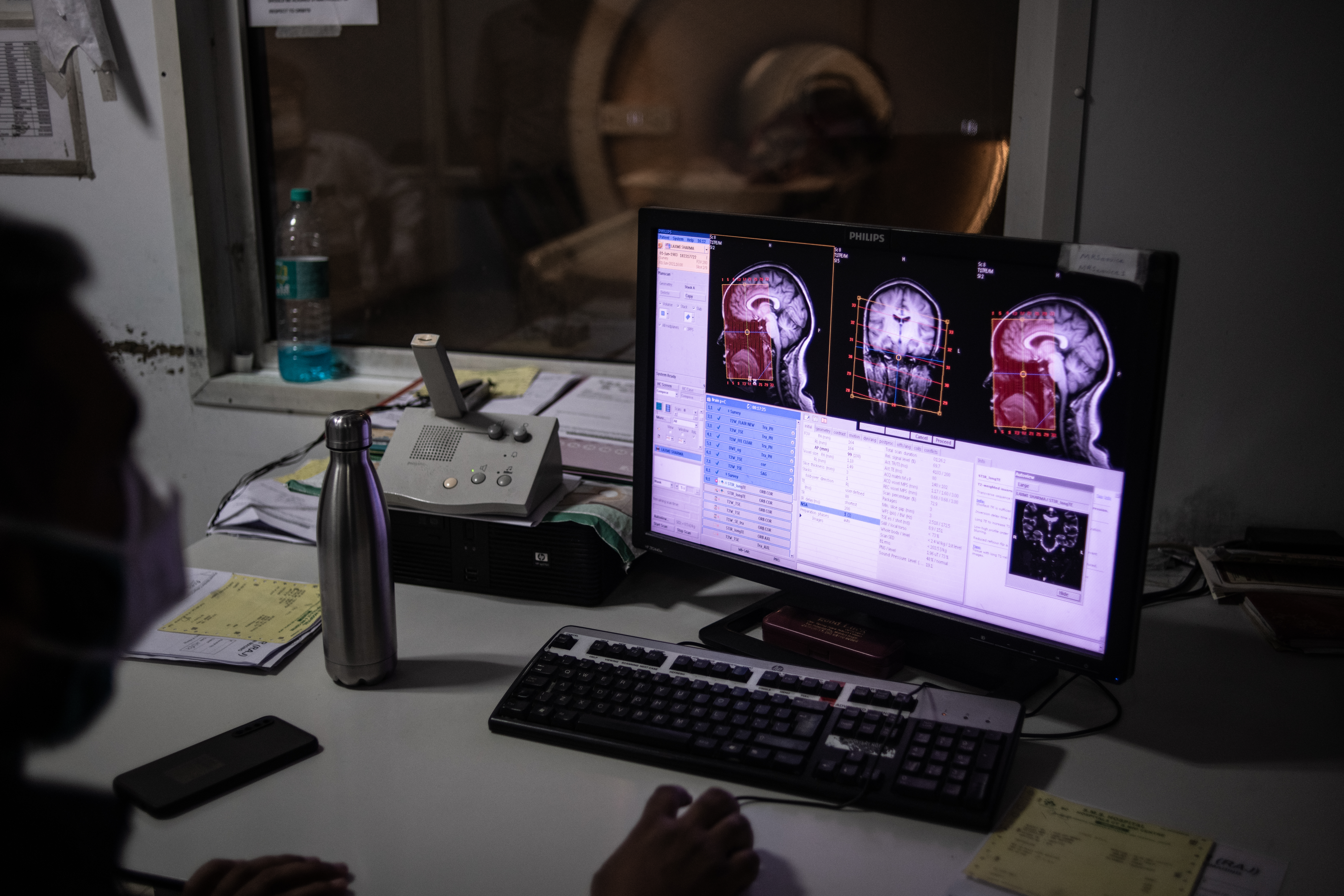 Alzheimer's Researchers Are Looking Beyond Plaques And Tangles For New Treatments - Vimarsana News